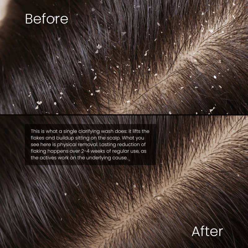 Hair Got Right - Scalp - Clarifying Anti-Dandruff Shampoo 85ml 