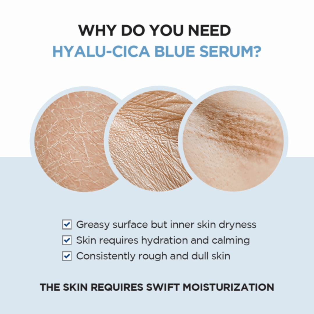 SKIN1004 Madagascar Centella Hyalu-Cica Blue Serum 30ml 