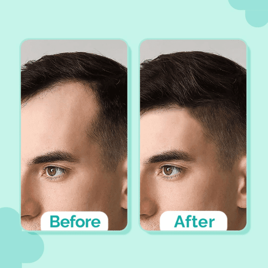 The Derma CO Hair Growth Serum with 20% Actives Peptide Stem Cell 30ml 