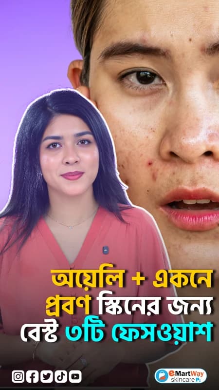Best 3 Face Washes for Oily & Acne-Prone Skin | Expert Picks