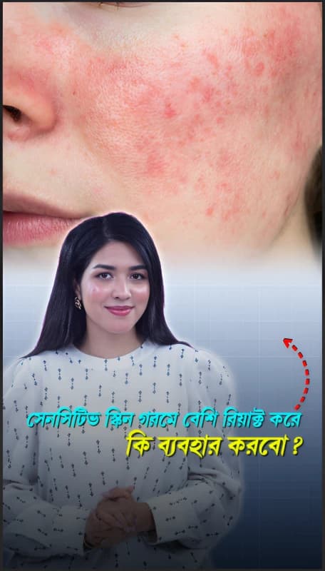 Sensitive Skin Reacts More in Summer? Here's What to Use
