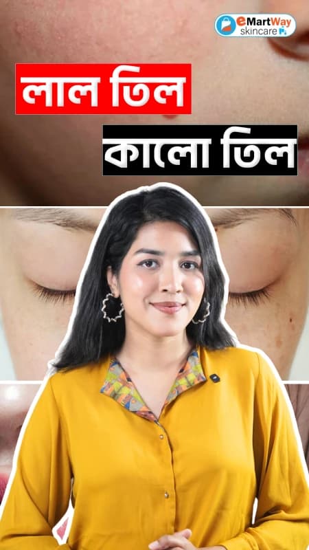 Solution for red and black moles